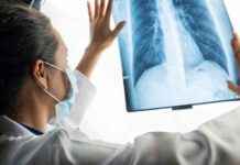 Krebsmetastasen: Symptome und Diagnose bei fortgeschrittener Krebserkrankung news-06082024-202031