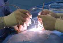 Schädelbohrung bei 13-Jähriger: Abschlussbericht ohne Beschuldigte news-27092024-134644