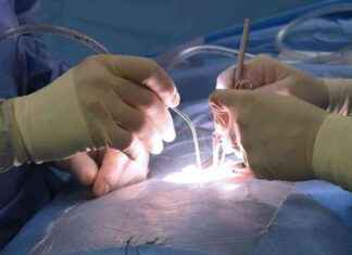 Schädelbohrung bei 13-Jähriger: Abschlussbericht ohne Beschuldigte news-27092024-134644