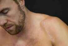 Ski Alpin: Aleksander Kilde verletzt – Saison verpasst news-30102024-011052