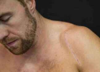 Ski Alpin: Aleksander Kilde verletzt – Saison verpasst news-30102024-011052